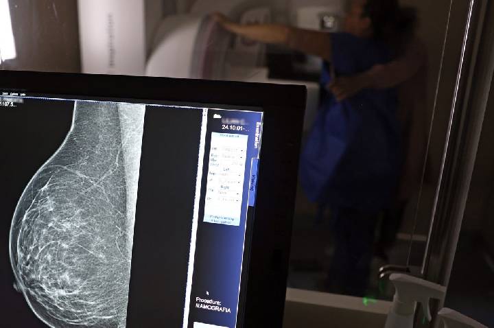 Nova lei reforça direito a três folgas por ano para exames preventivos